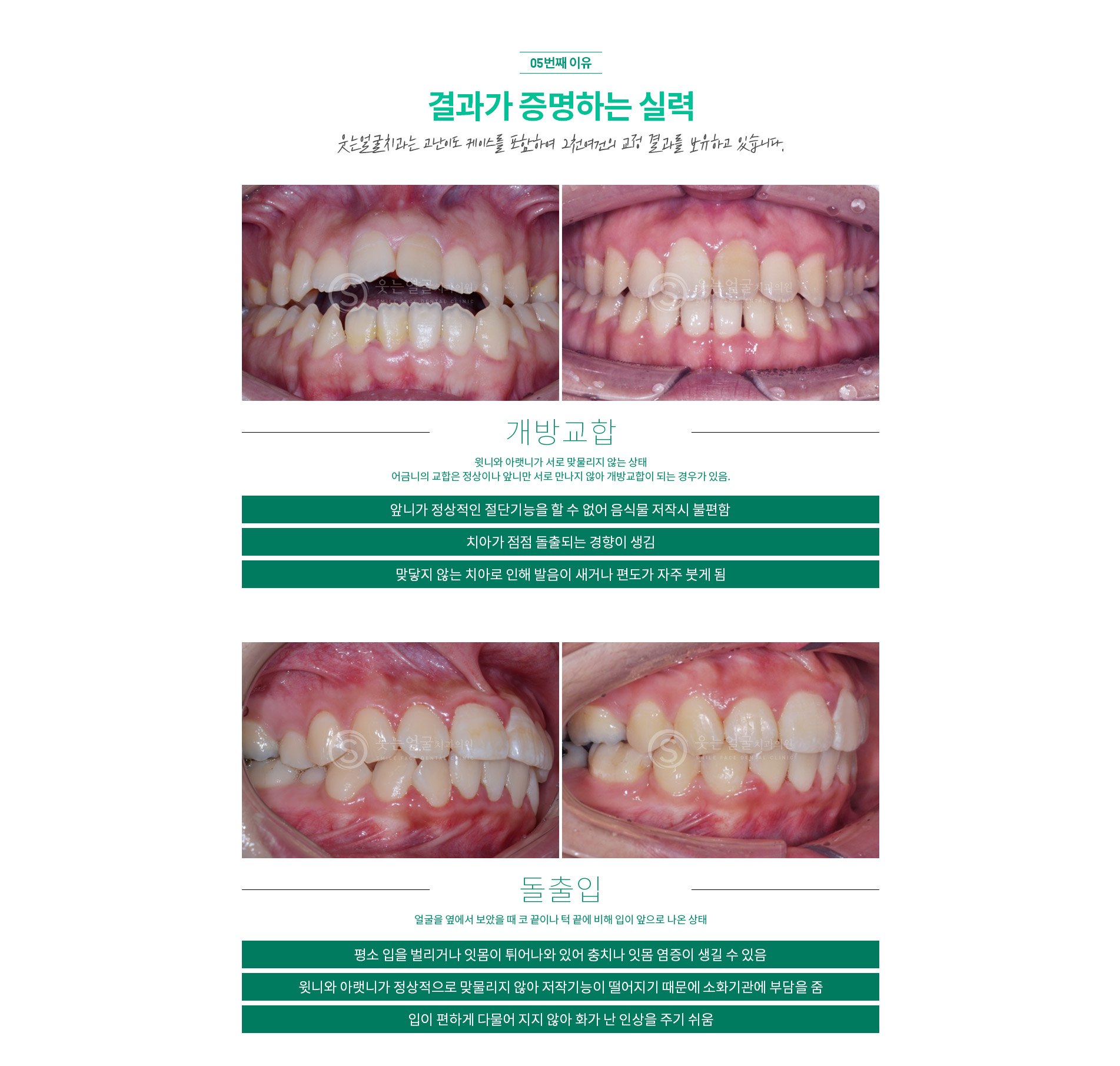 교정전후사진