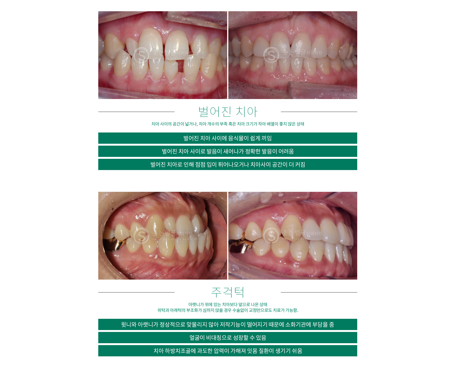교정전후사진